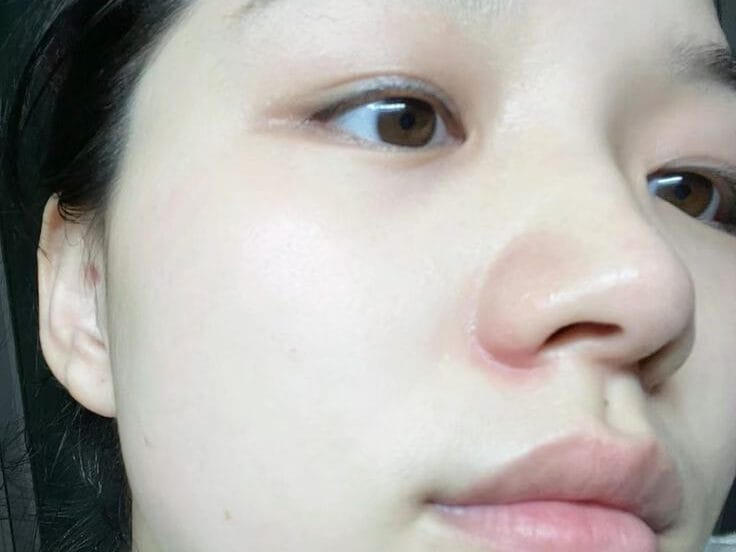 Da Dầu Nên Phun Xăm Hay Điêu Khắc? Lưu Ý Trước Khi Quyết Định 11 da dau nen phun xam hay dieu khac Ms Hani 3 edited