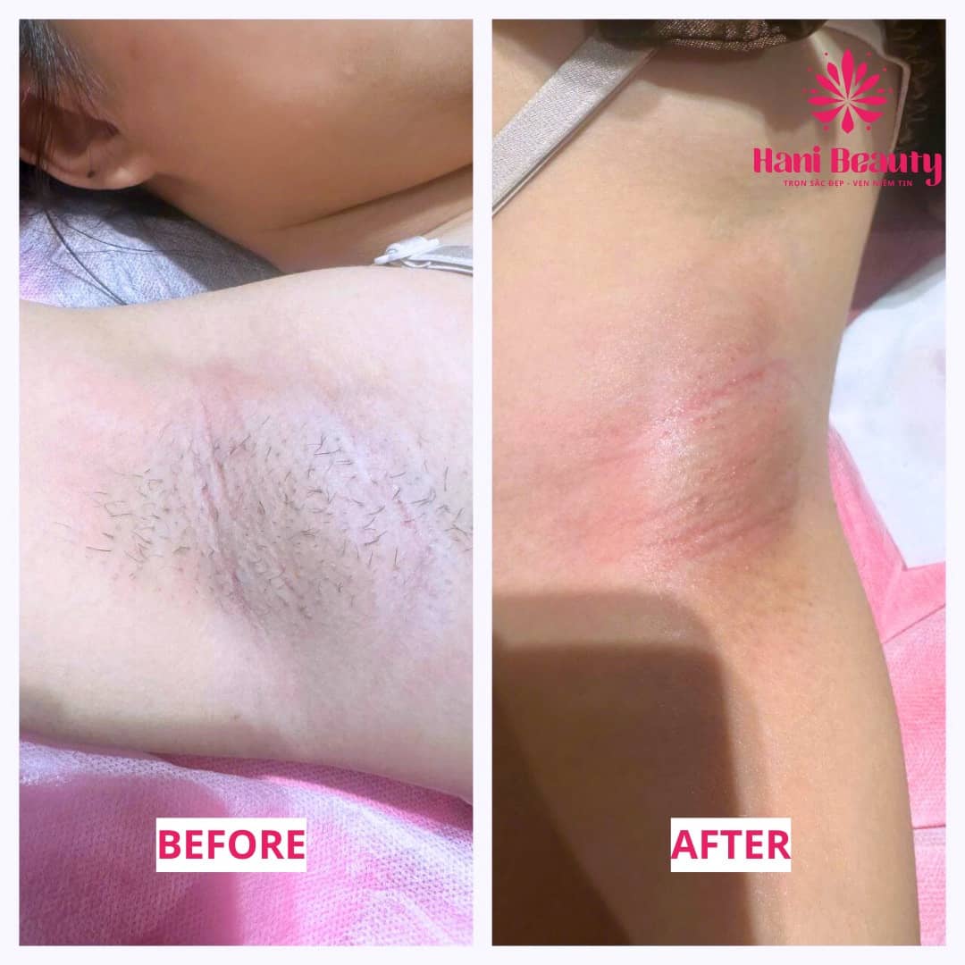 Học Waxing Cần Chuẩn Bị Gì? 5 Điều Quan Trọng & Học Phí Ưu Đãi 2025